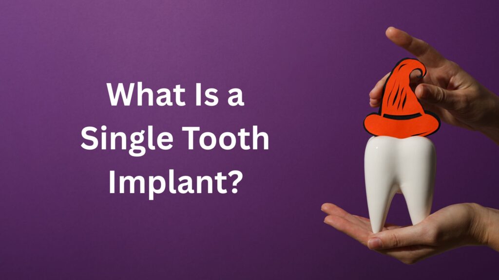 What Is a Single Tooth Implant?